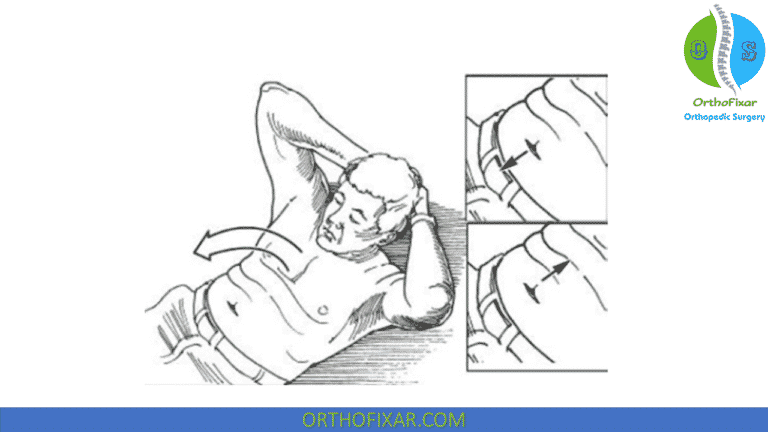 Beevor Sign: Clinical Test For Rectus Abdominis Weakness And Spinal ...
