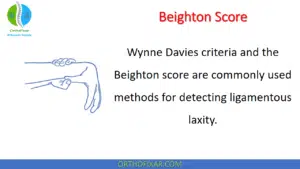 Beighton Score for Ligamentous Laxity