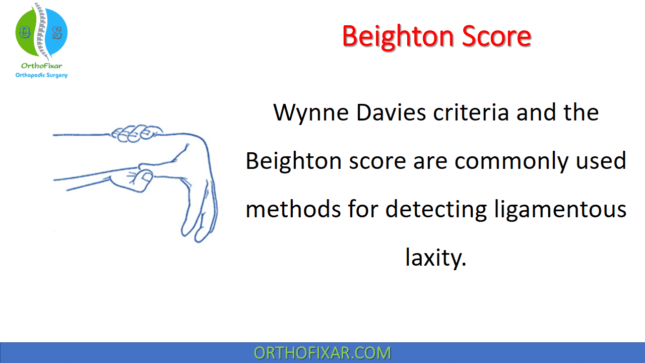  Beighton Score 