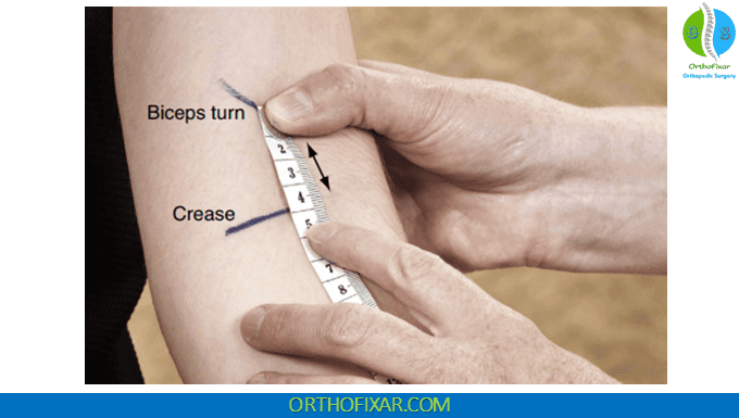 Biceps Crease Interval 2 Biceps Crease Interval measurment