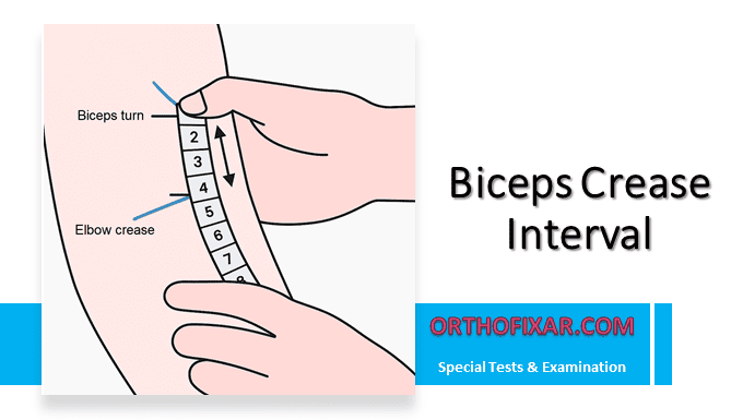 Biceps Crease Interval