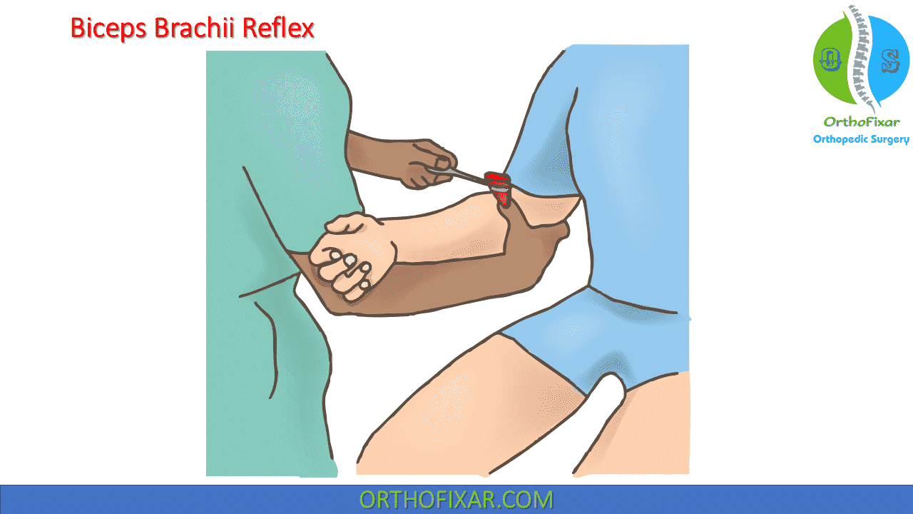 Biceps Reflex Test: Technique, Interpretation, And Clinical Significance