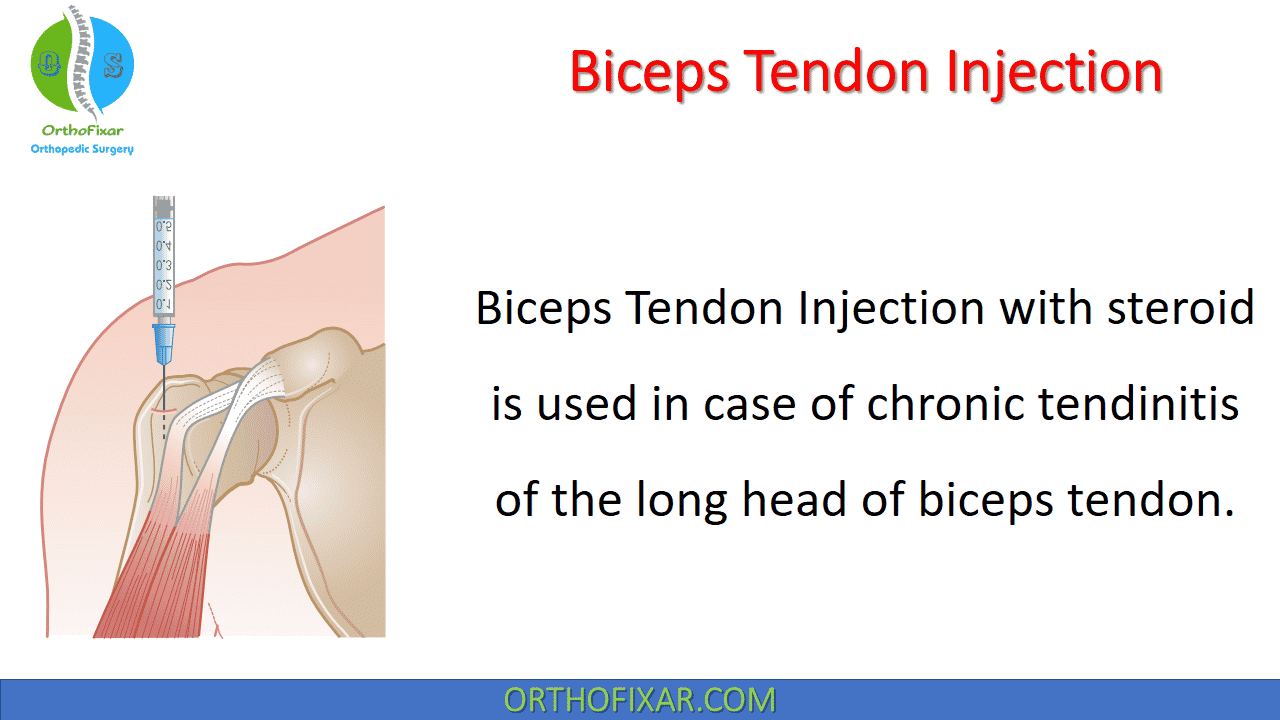  Biceps Tendon Injection 