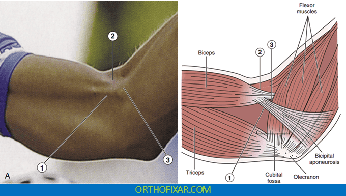 Bicipital Aponeurosis Flex Test 1 Bicipital Aponeurosis Flex Test