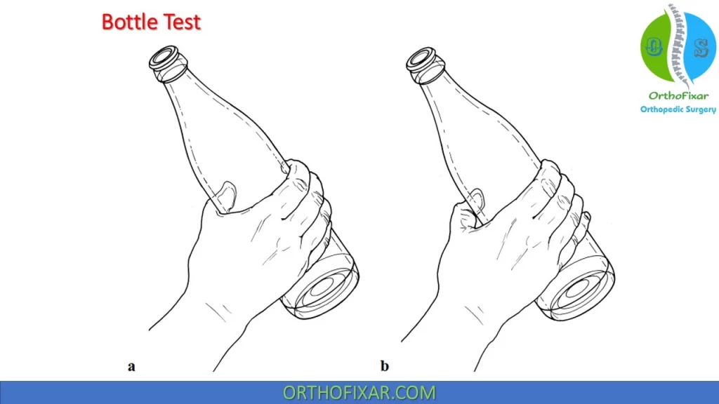 Bottle Test - Median nerve palsy