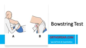 Bowstring Test