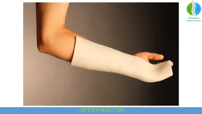 Boxer’s Fracture cast