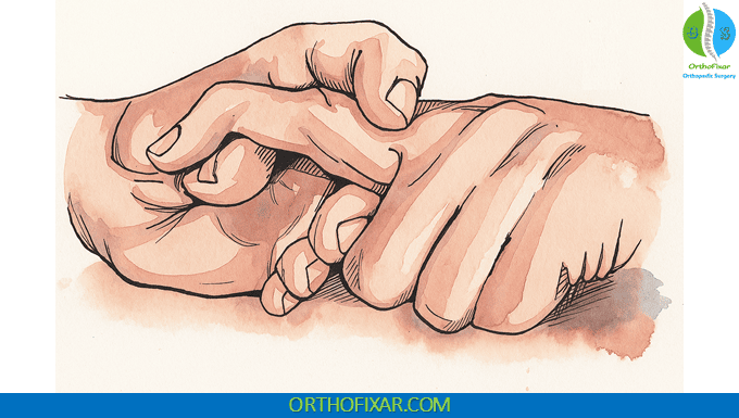 Boyes Test for Central Slip Injuries 1 Boyes Test for Central Slip Injuries