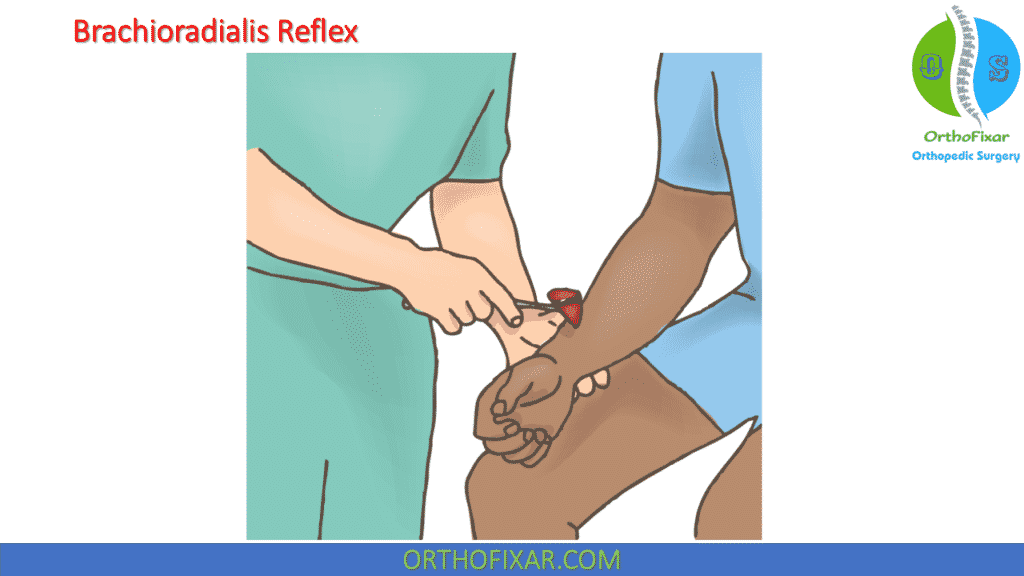 Brachioradialis Reflex