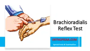 Brachioradialis Reflex Test
