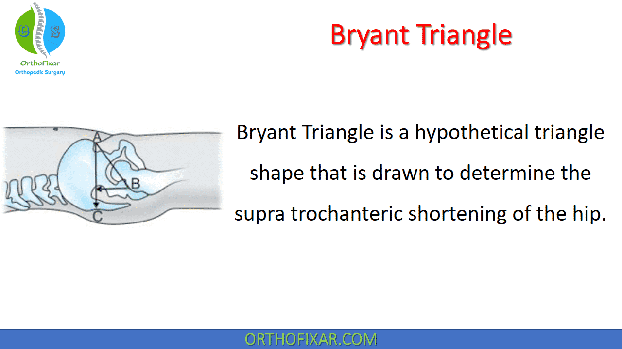 Bryant Triangle