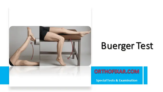 Buerger Test