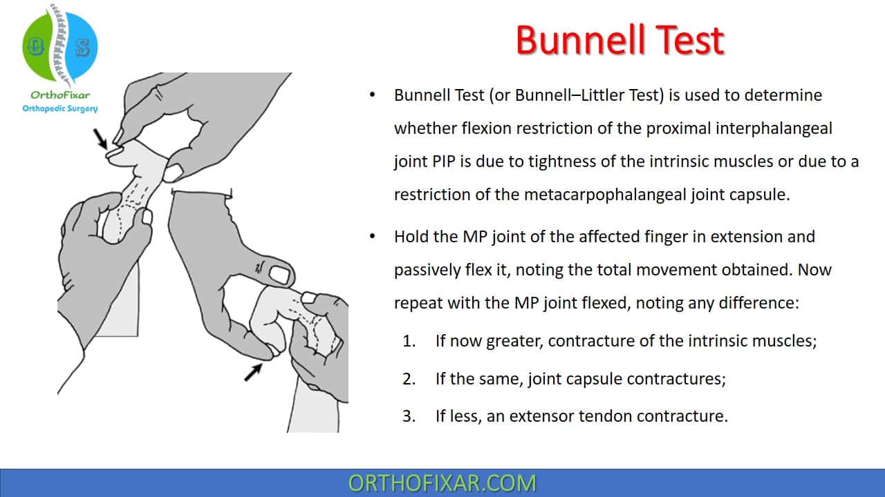  Bunnell Test for Intrinsic Tightness 