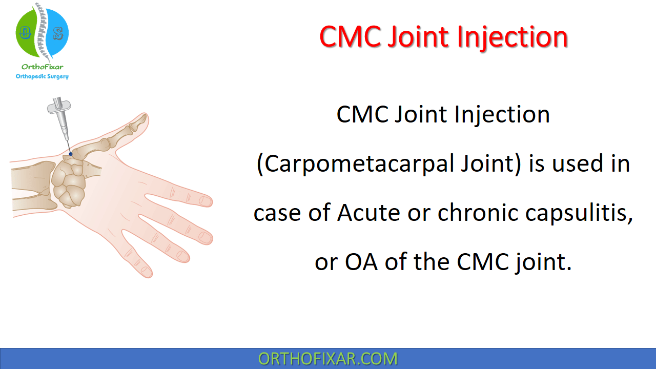 CMC Joint Injection