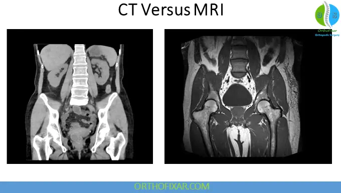 CT scan Versus MRI