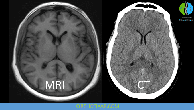 CT vs MRI: Differences, Indications and Image Interpretation 5 CT vs MRI