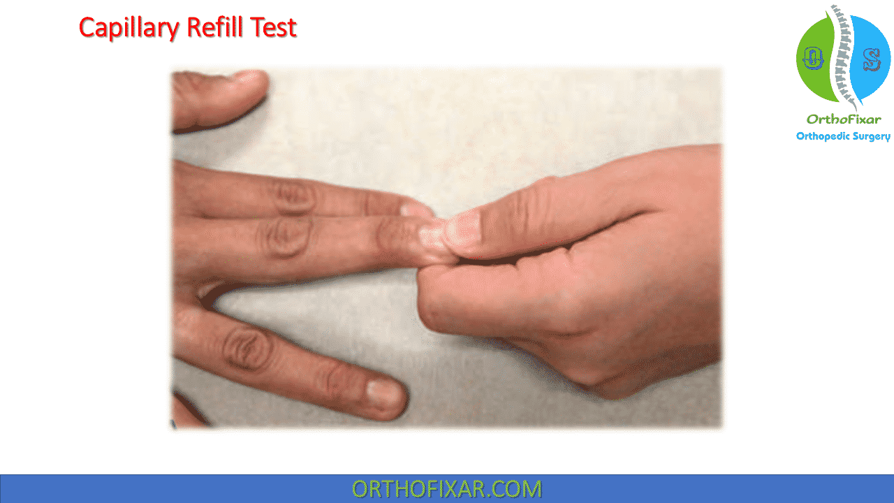 Capillary Refill Test Easy Explained Orthofixar 2023