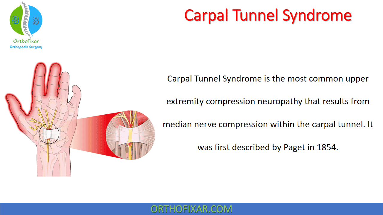  Carpal Tunnel Syndrome 