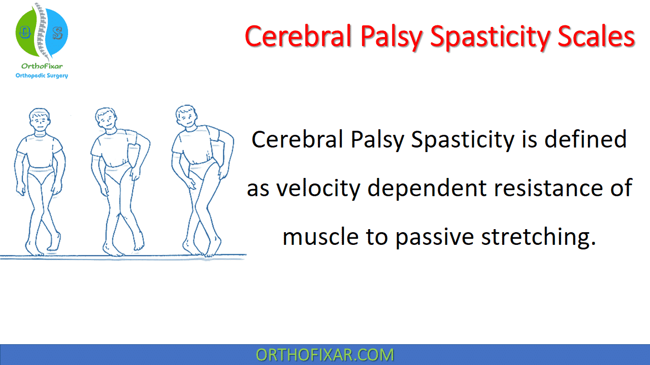  Cerebral Palsy Spasticity Scales 