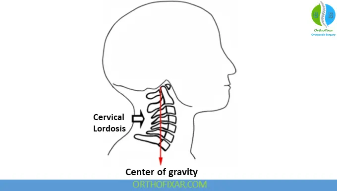 Cervical Lordosis