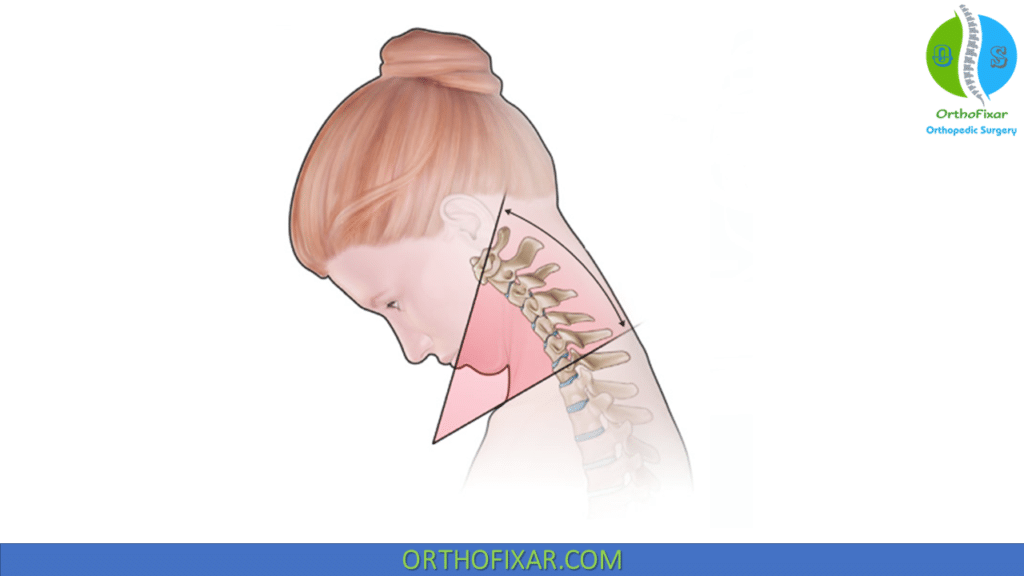 Cervical Spine Range Of Motion | Orthoepdic Examination 2023