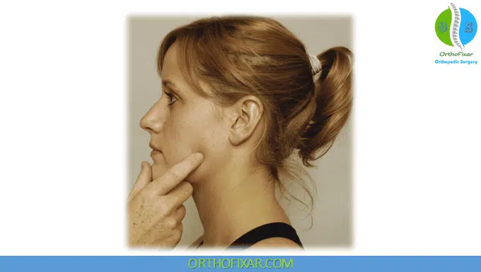 Chvostek Sign Test 1 Chvostek Sign test