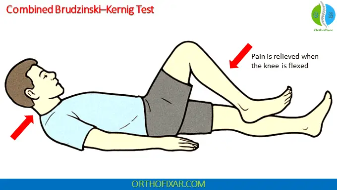 Kernig Sign & Brudzinski Sign 3 Combined Brudzinski–Kernig Test