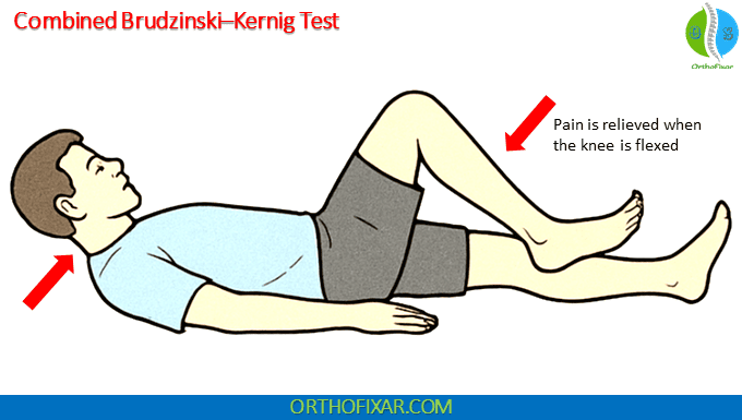 Combined Brudzinski–Kernig Test