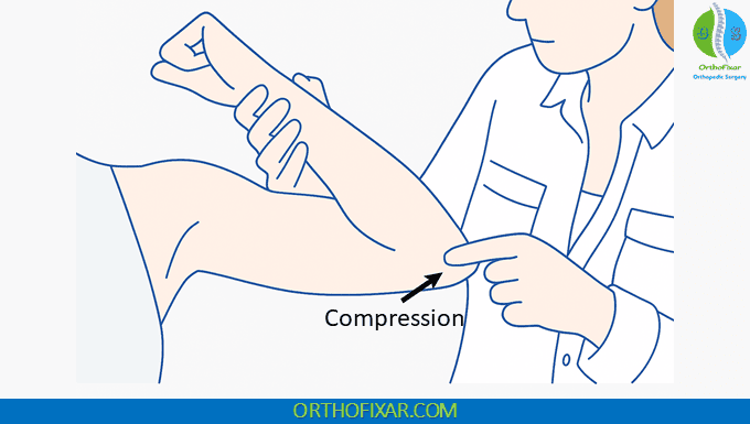 Compression Wadsworth Elbow Flexion Test