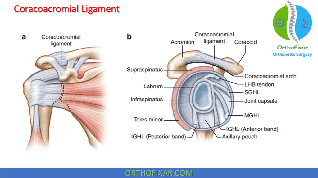 Coracoacromial Ligament