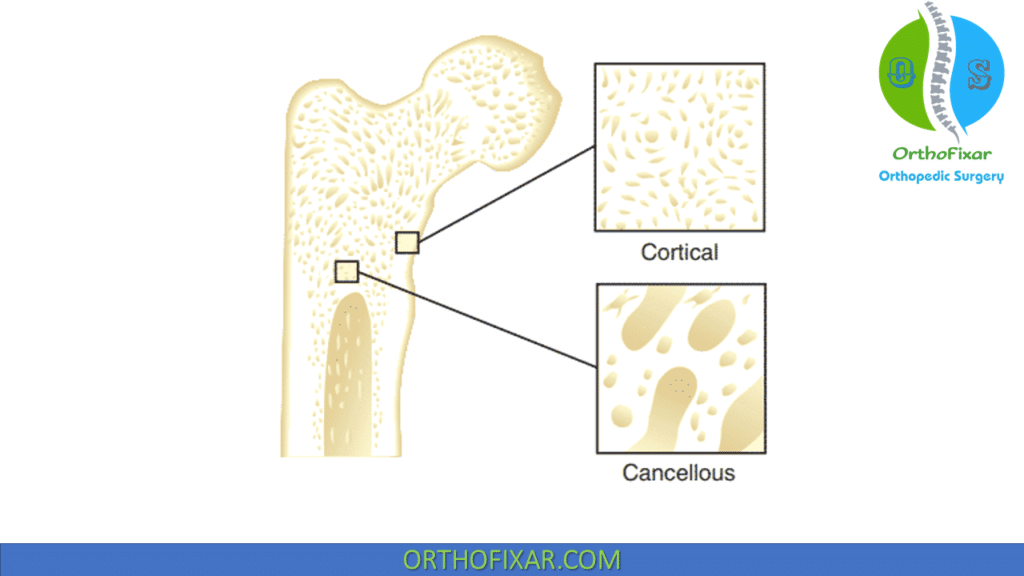 Cortical VS Cancellous bone
