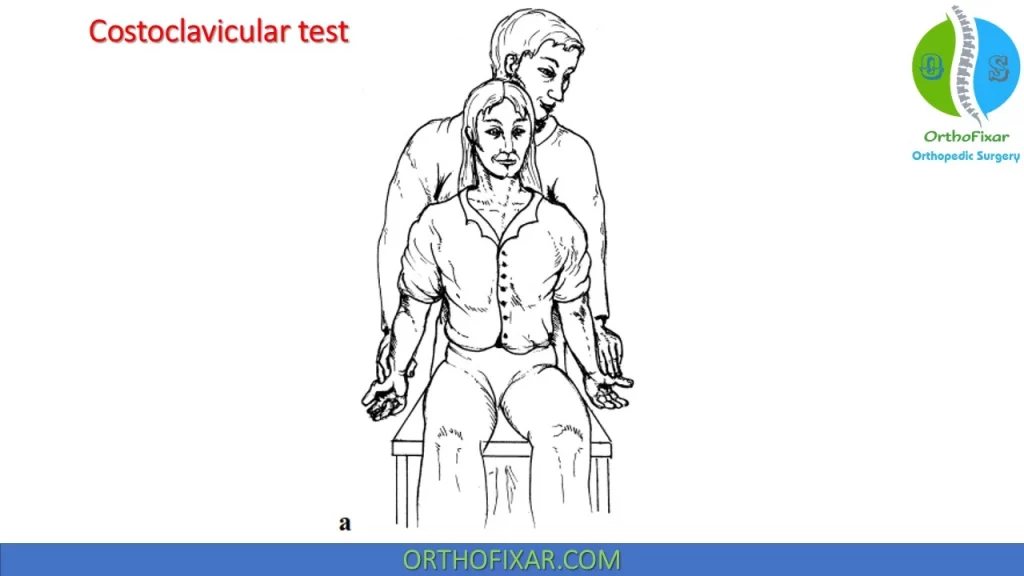 Costoclavicular Test