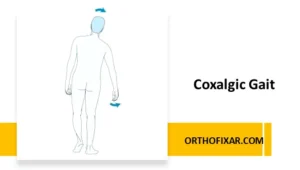 Coxalgic Gait 9 Coxalgic Gait