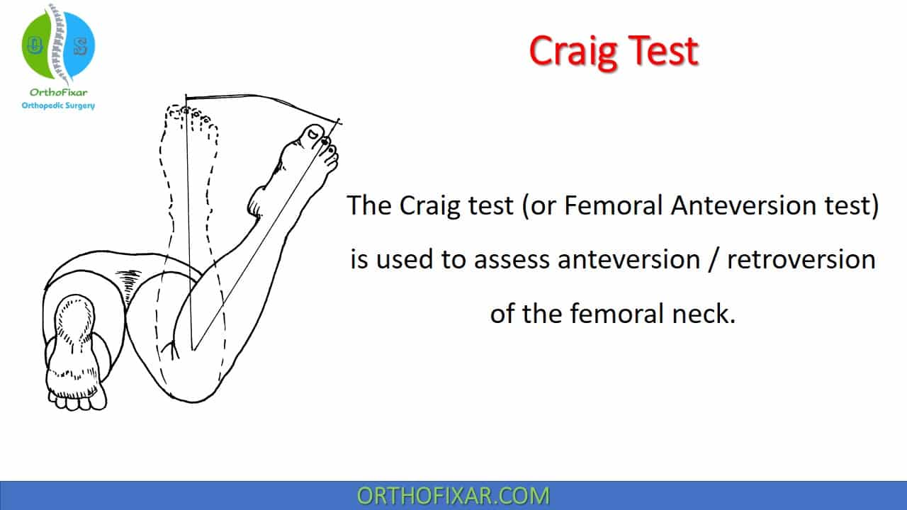  Craig Test 