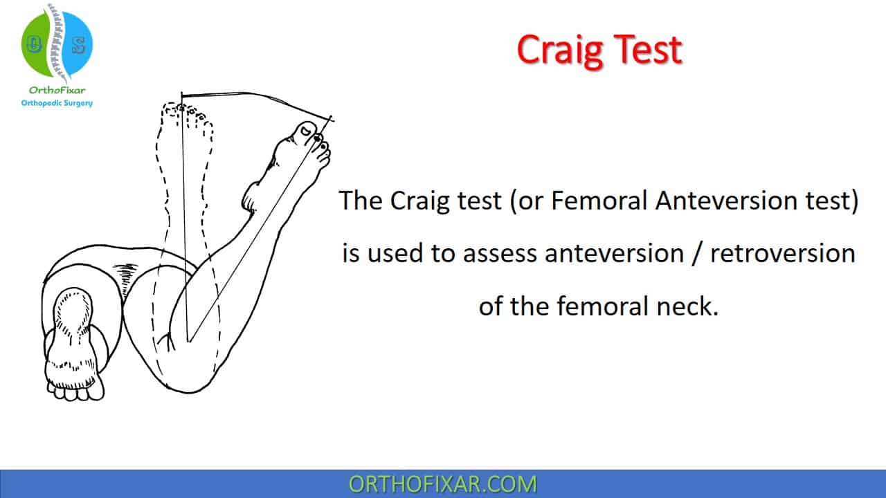 femoral anteversion angle