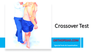 Crossover Test of the Knee 6 Crossover Test