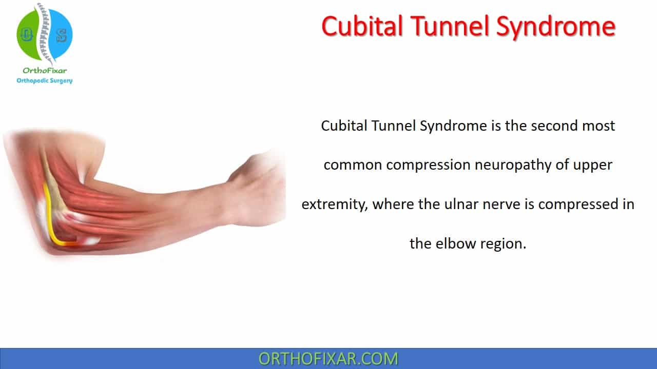 What is Cubital Tunnel Syndrome - Coastal Orthopedics