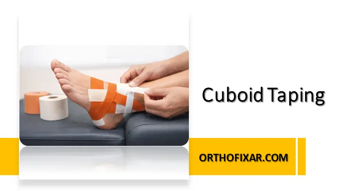 Cuboid Taping Technique