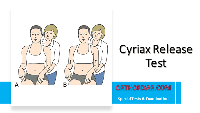 Cyriax Release Test