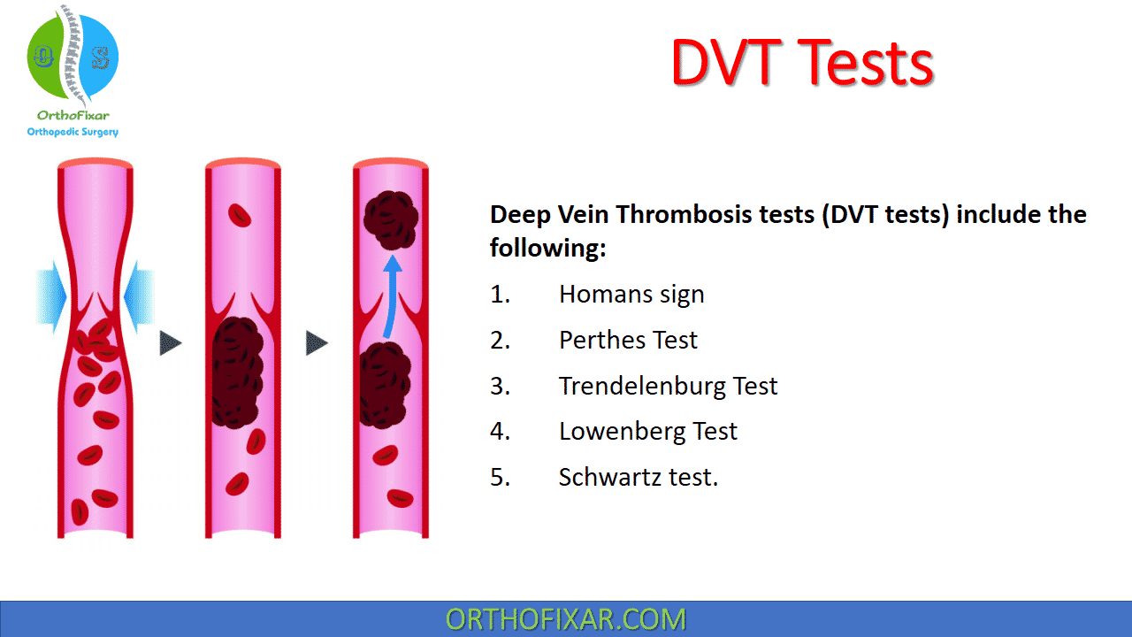  DVT Tests 