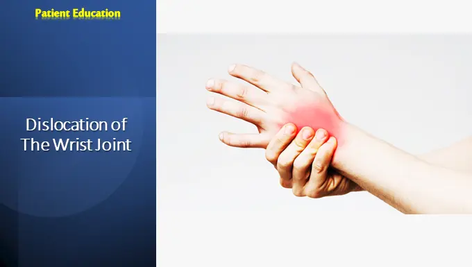 Dislocation of The Wrist Joint