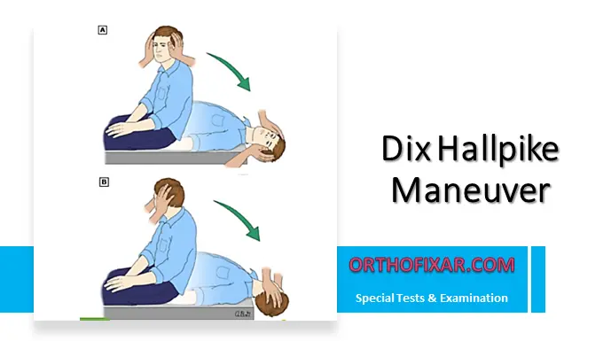 Dix Hallpike Maneuver Test