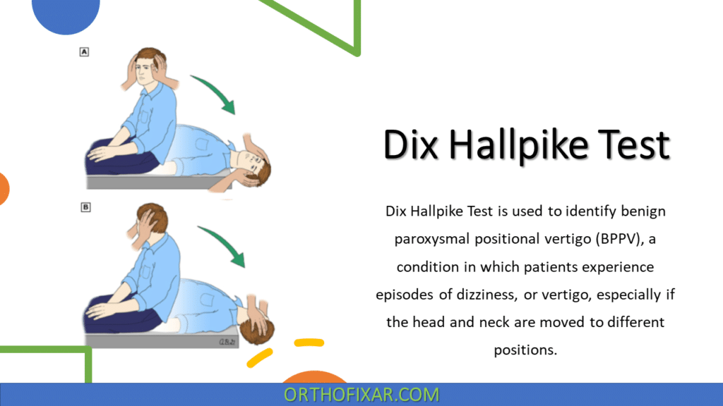 Dix Hallpike Test & Maneuver | OrthoFixar 2025