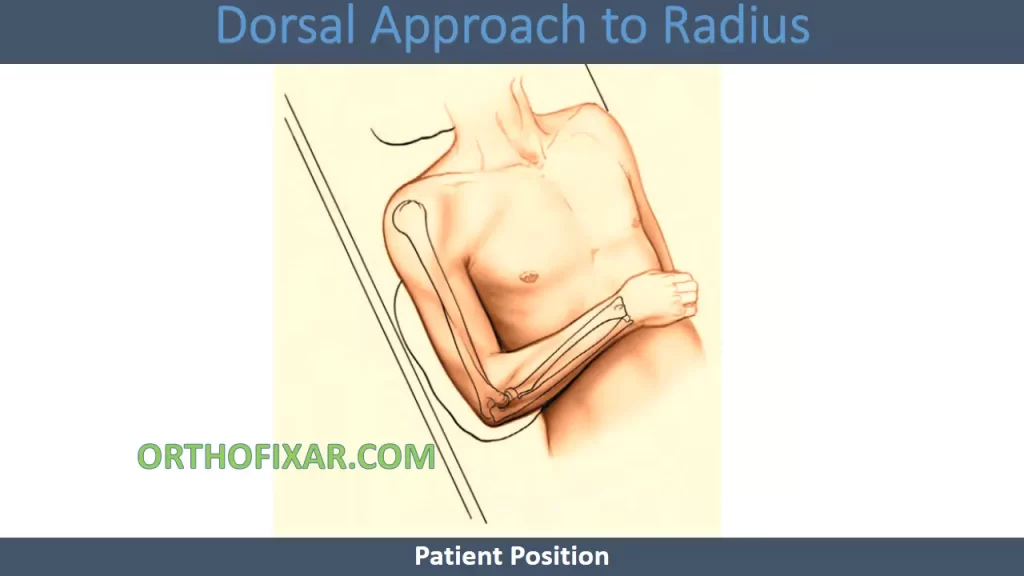 Dorsal Approach to Radius-patient position