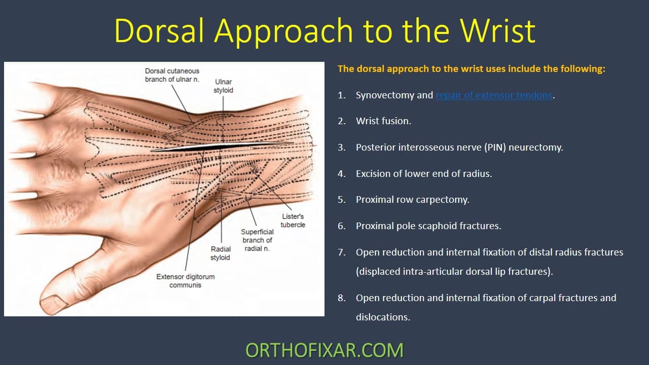  Dorsal Approach to the Wrist 
