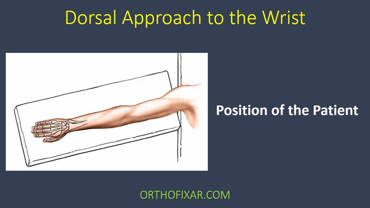 Dorsal Approach To The Wrist