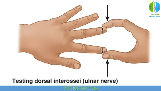 Testing Interossei Strength Dorsal Interossei Muscles Of The Hand | OrthoFixar 2026