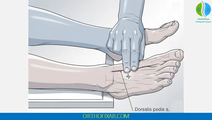 Dorsalis Pedis Pulse palpation