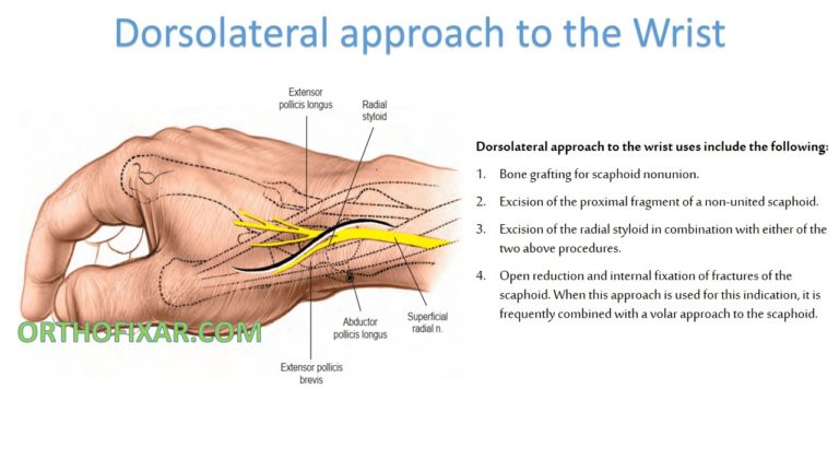 Dorsolateral approach to the Wrist