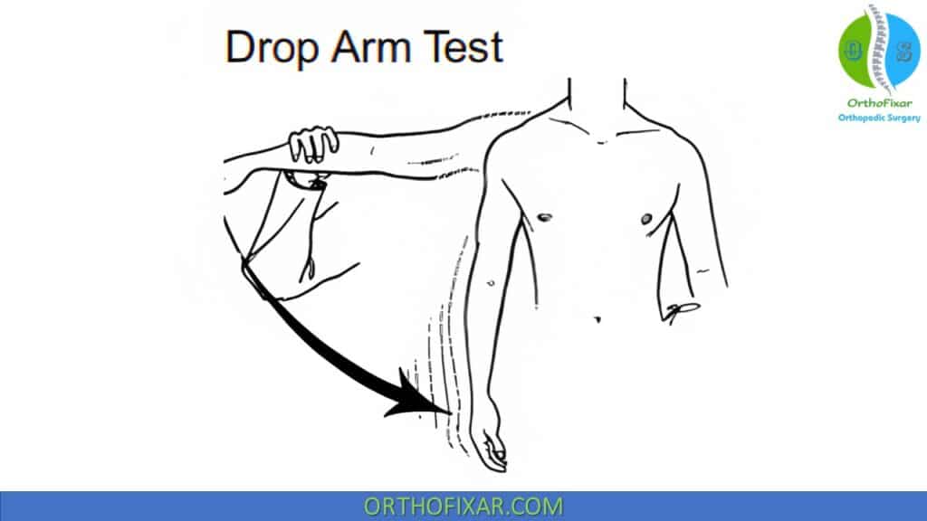 Drop Arm Test
